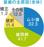 抜歯の主原因（全体）