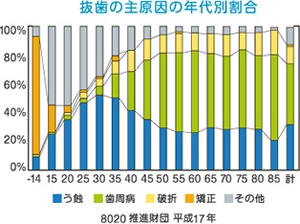 抜歯の主原因の年代別割合