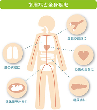 歯周病と全身疾患